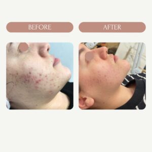 Before / After 1