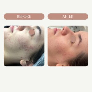 Before / After 2