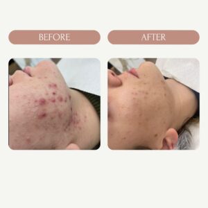 Before / After 3