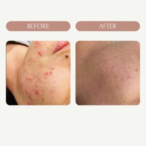 Before / After 4