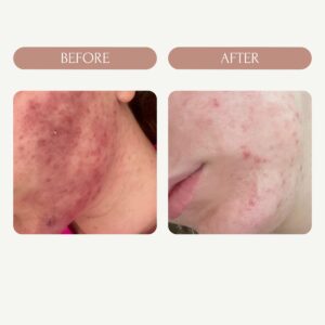 Before / After 5