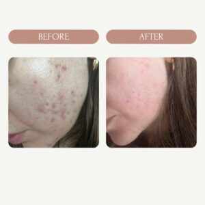 Before / After 6