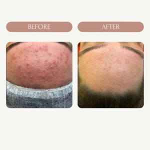 Before / After 7