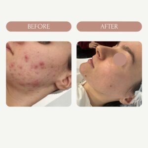 Before / After 8