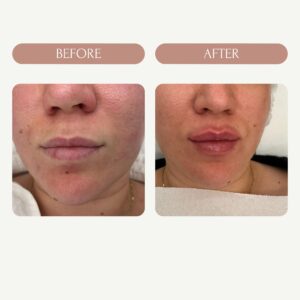 Before / After 9