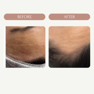 Before / After 10